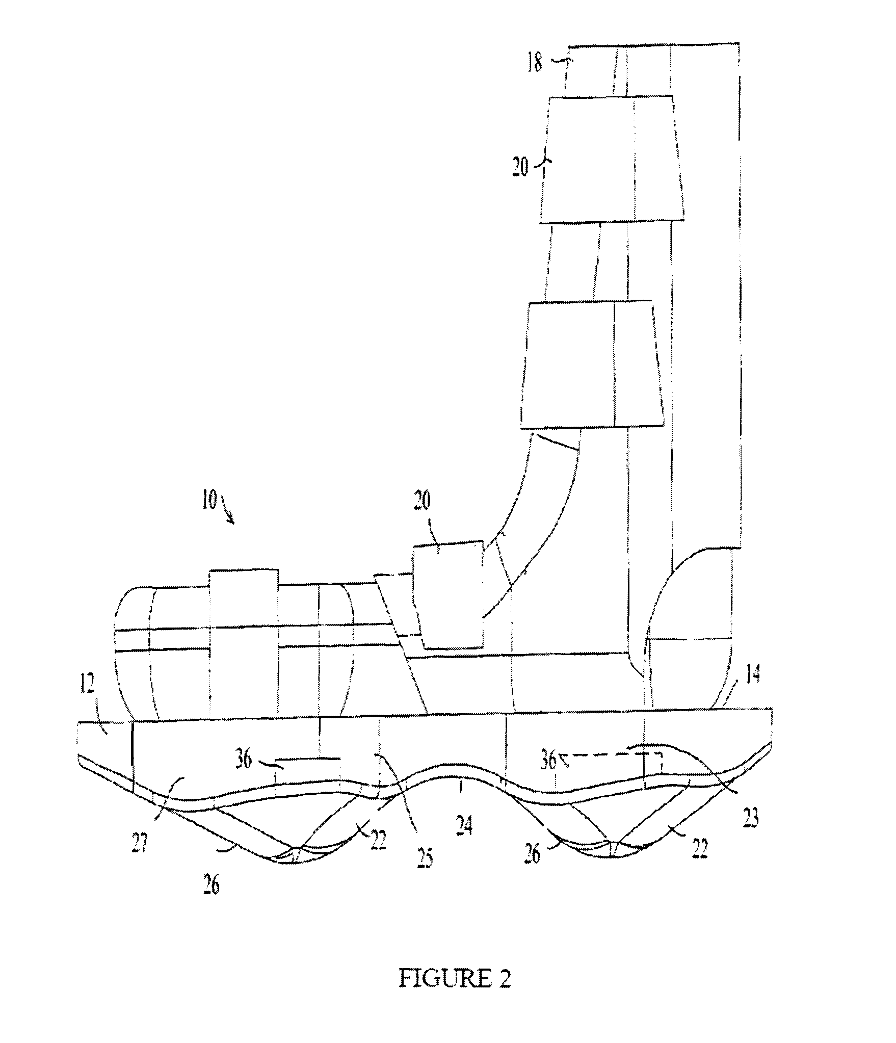 Method for treating urinary incontinence