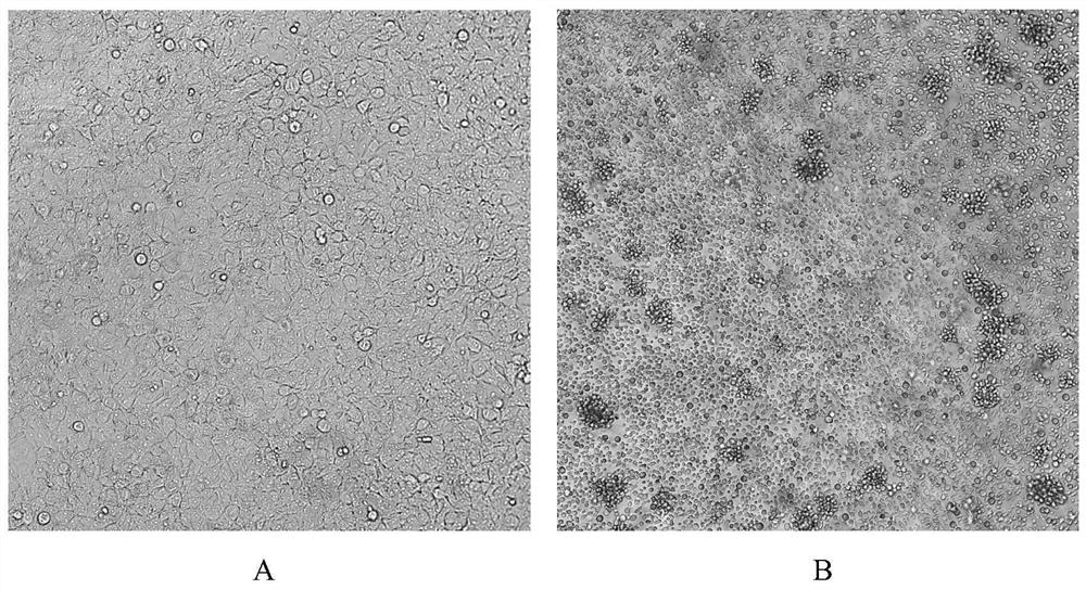 Immortalized porcine macrophage cell strain as well as construction method and application thereof