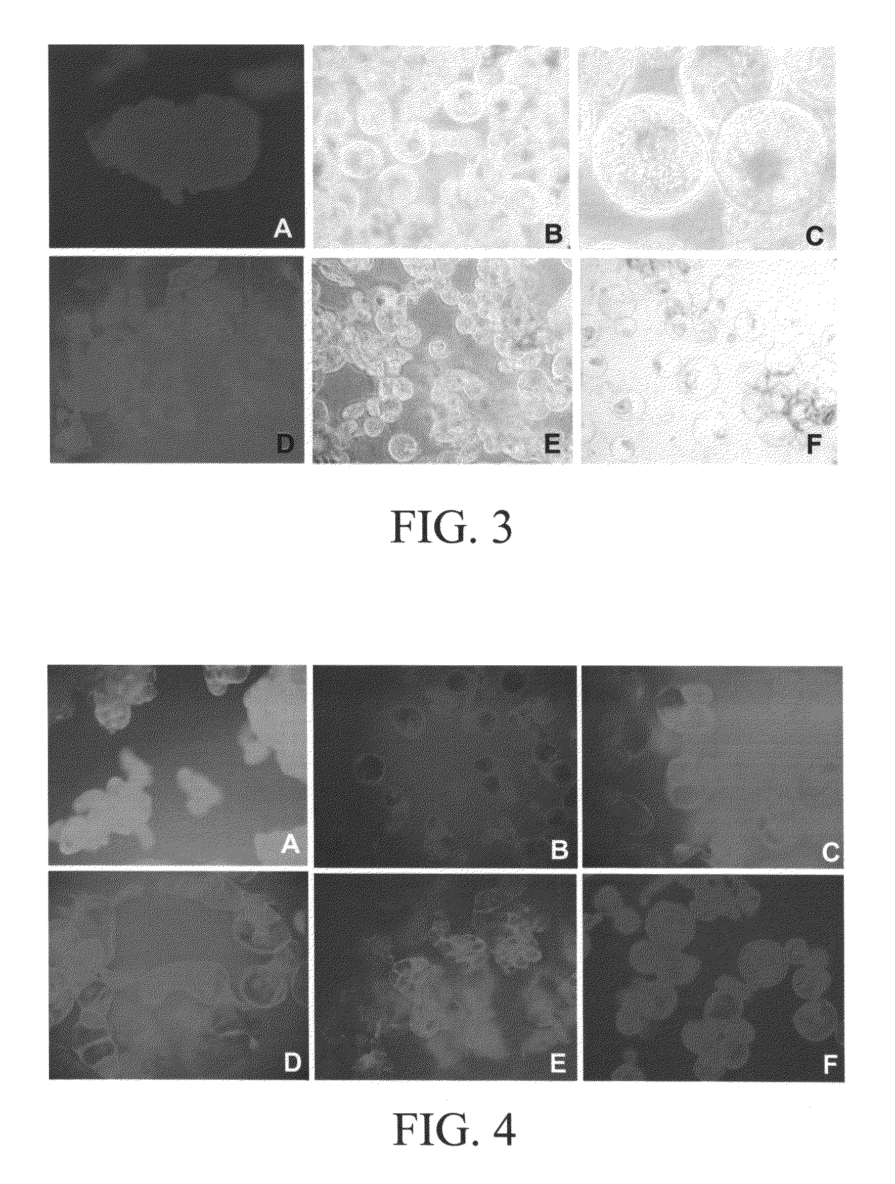 In vitro methods for the induction and maintenance of plant cell lines as single suspension cells with intact cell walls, and transformation thereof