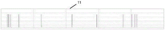 Circuit for automatically identifying and analyzing insulin pen injection sound