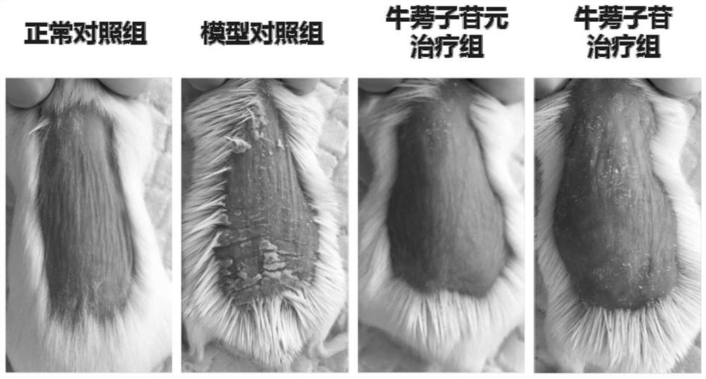 Local skin external preparation containing arctiin compounds based on solid particle emulsification technology and its preparation method and application