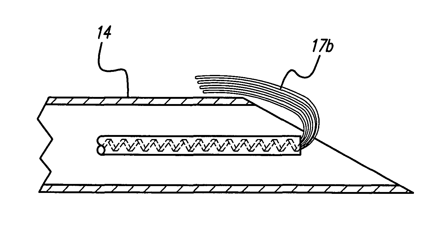 Implantable microdevice with extended lead and remote electrode