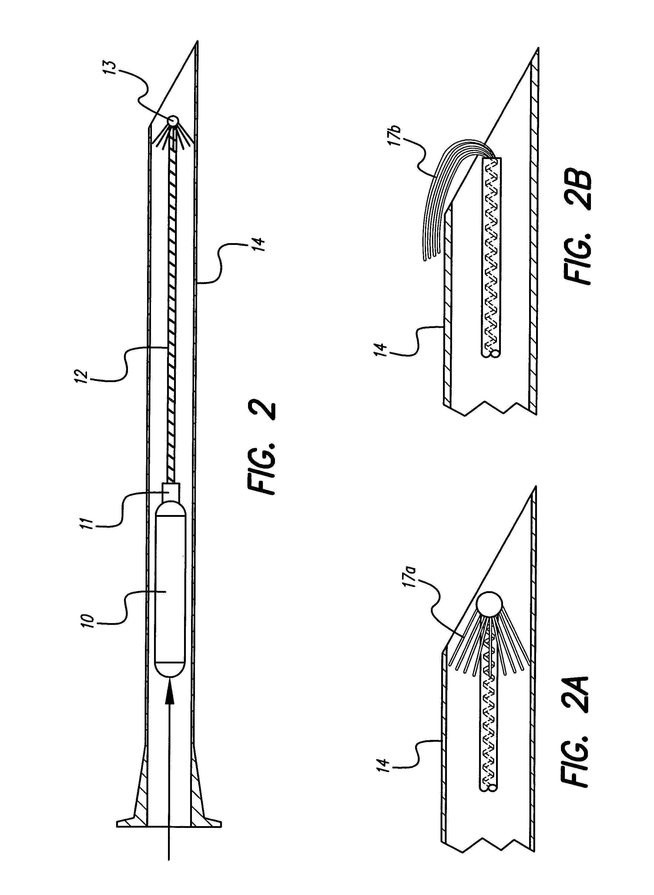 Implantable microdevice with extended lead and remote electrode