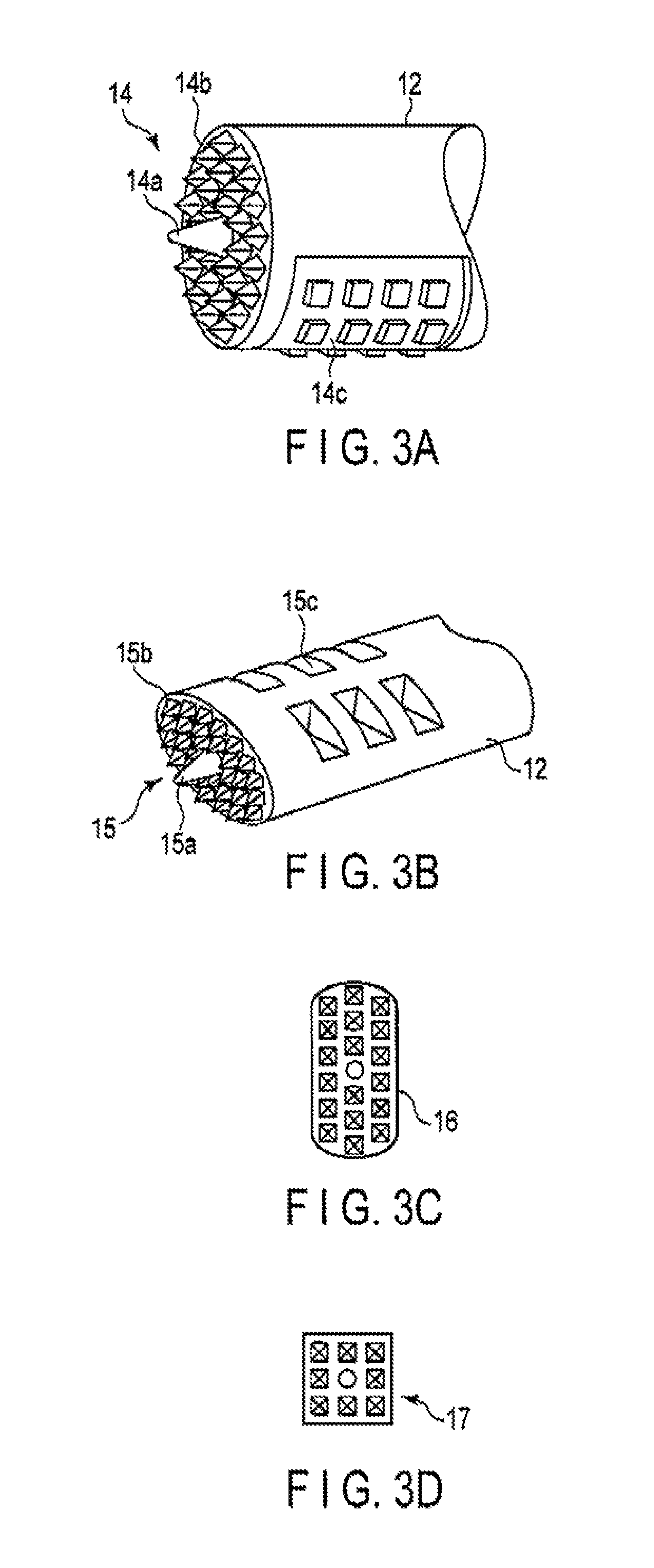 Arthroscopic surgery method for ankle ligament reconstruction