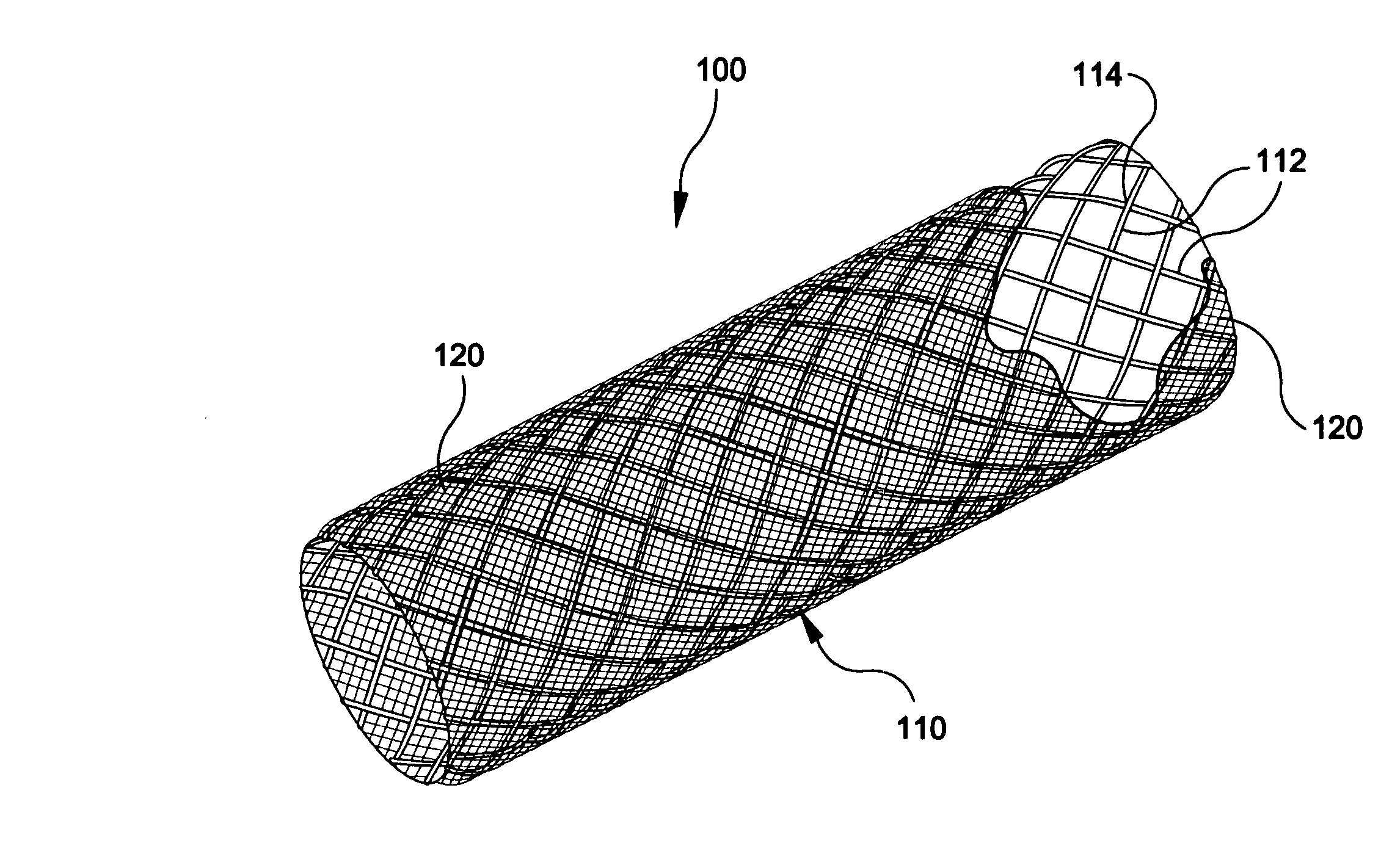 Stent-graft with bioabsorbable structural support