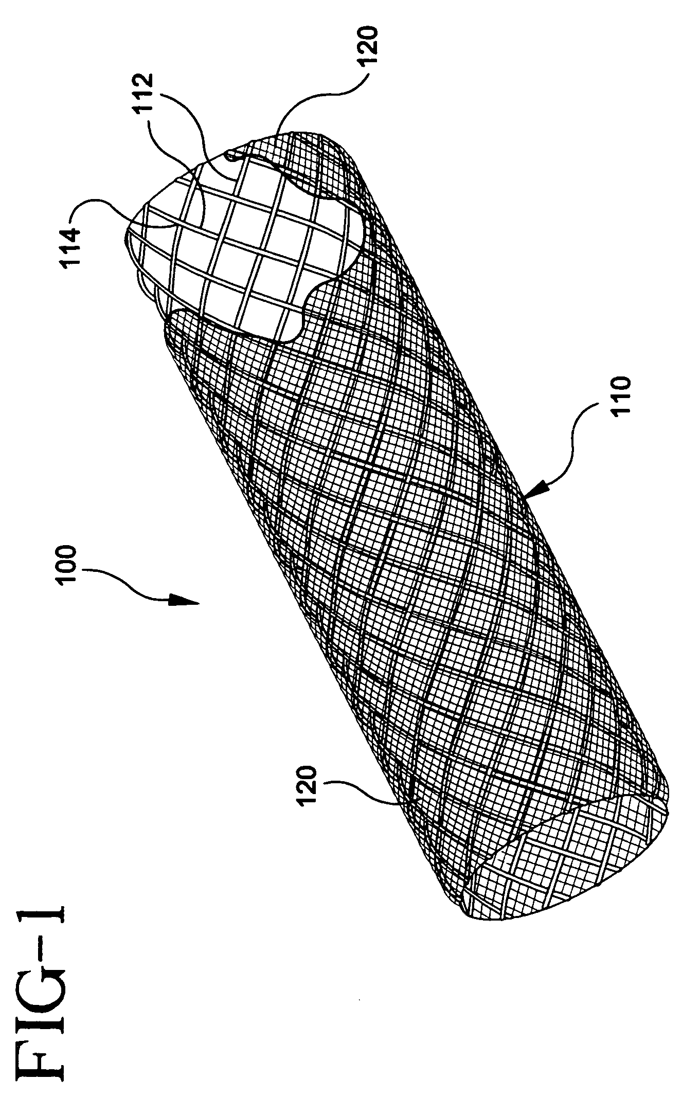 Stent-graft with bioabsorbable structural support
