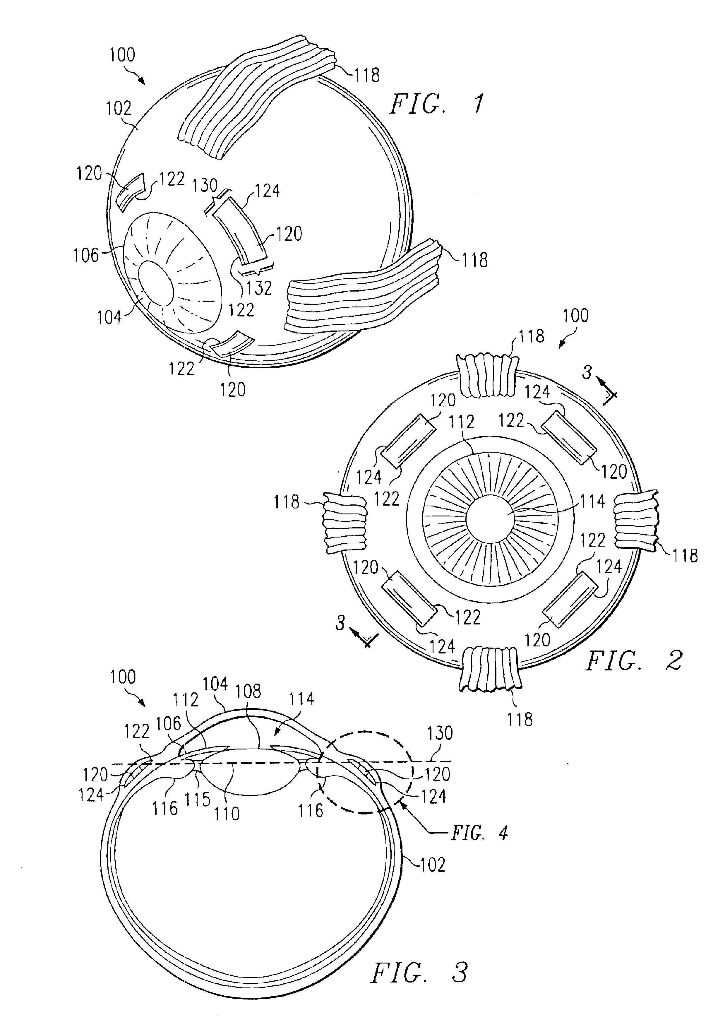 Surgical blade for use with a surgical tool for making incisions for scleral eye implants