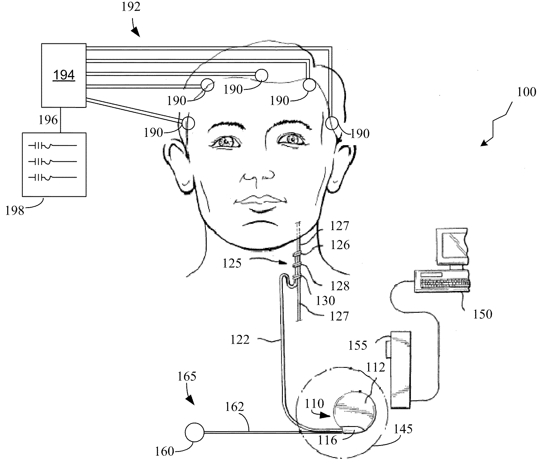 Implantable Medical Device for Providing Chronic Condition Therapy and Acute Condition Therapy Using Vagus Nerve Stimulation