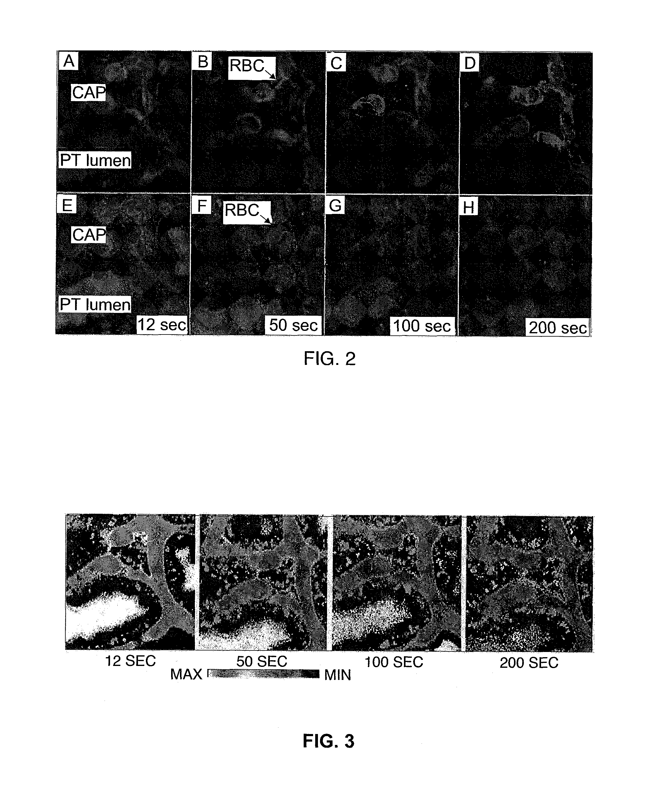 Renal function analysis method and apparatus