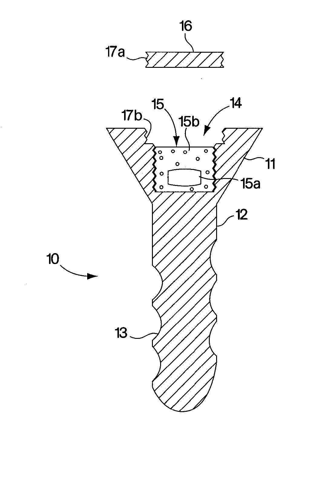 Device and Method for Treating Conditions of a Joint