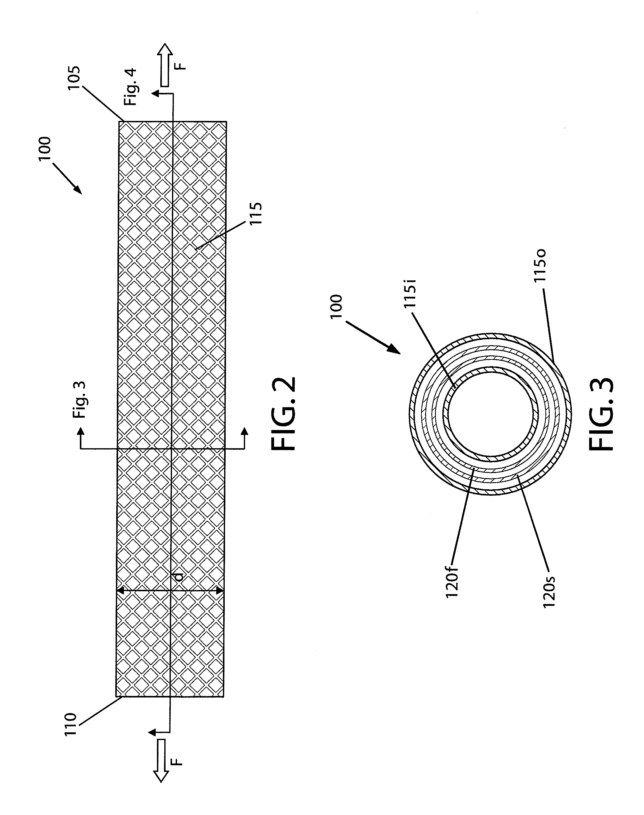 Device and method for treating vascular abnormalities