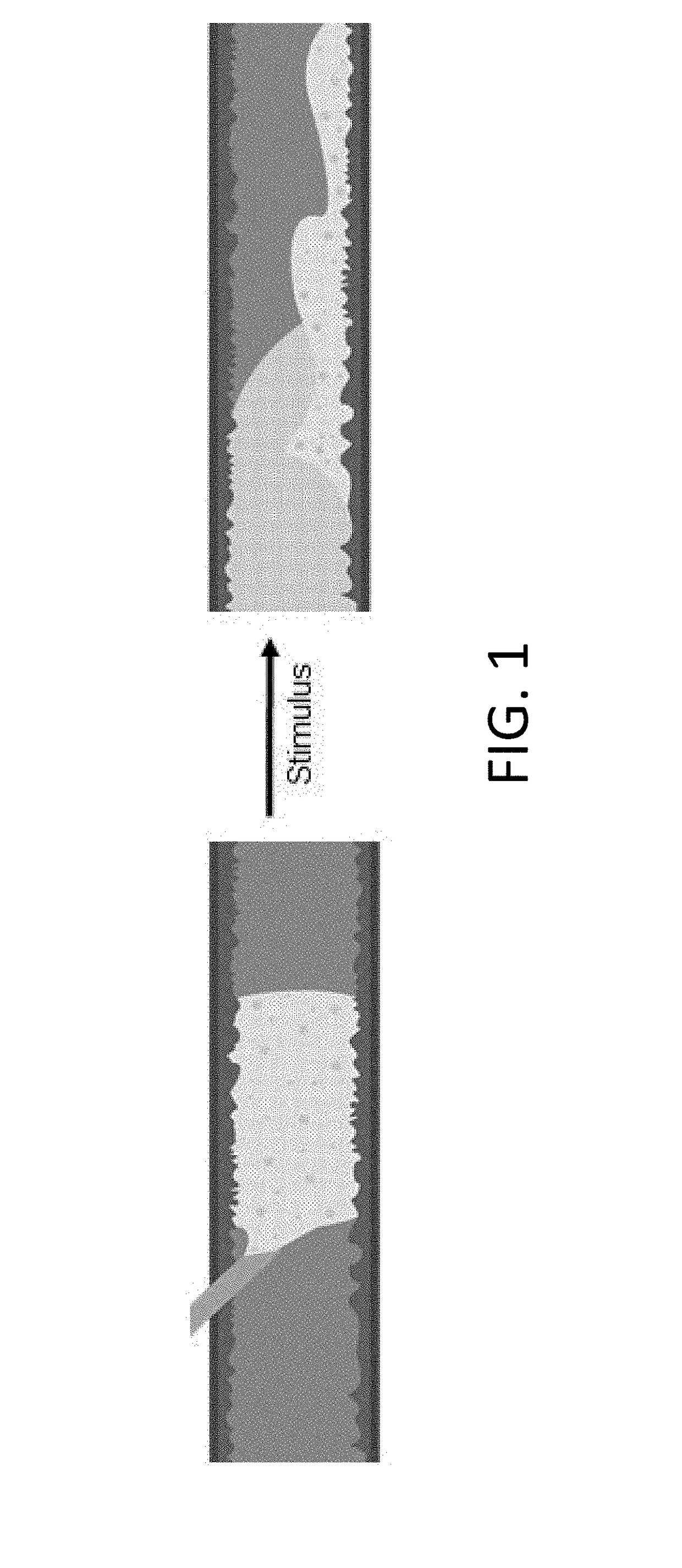 Long-lasting and degradable implant compositions