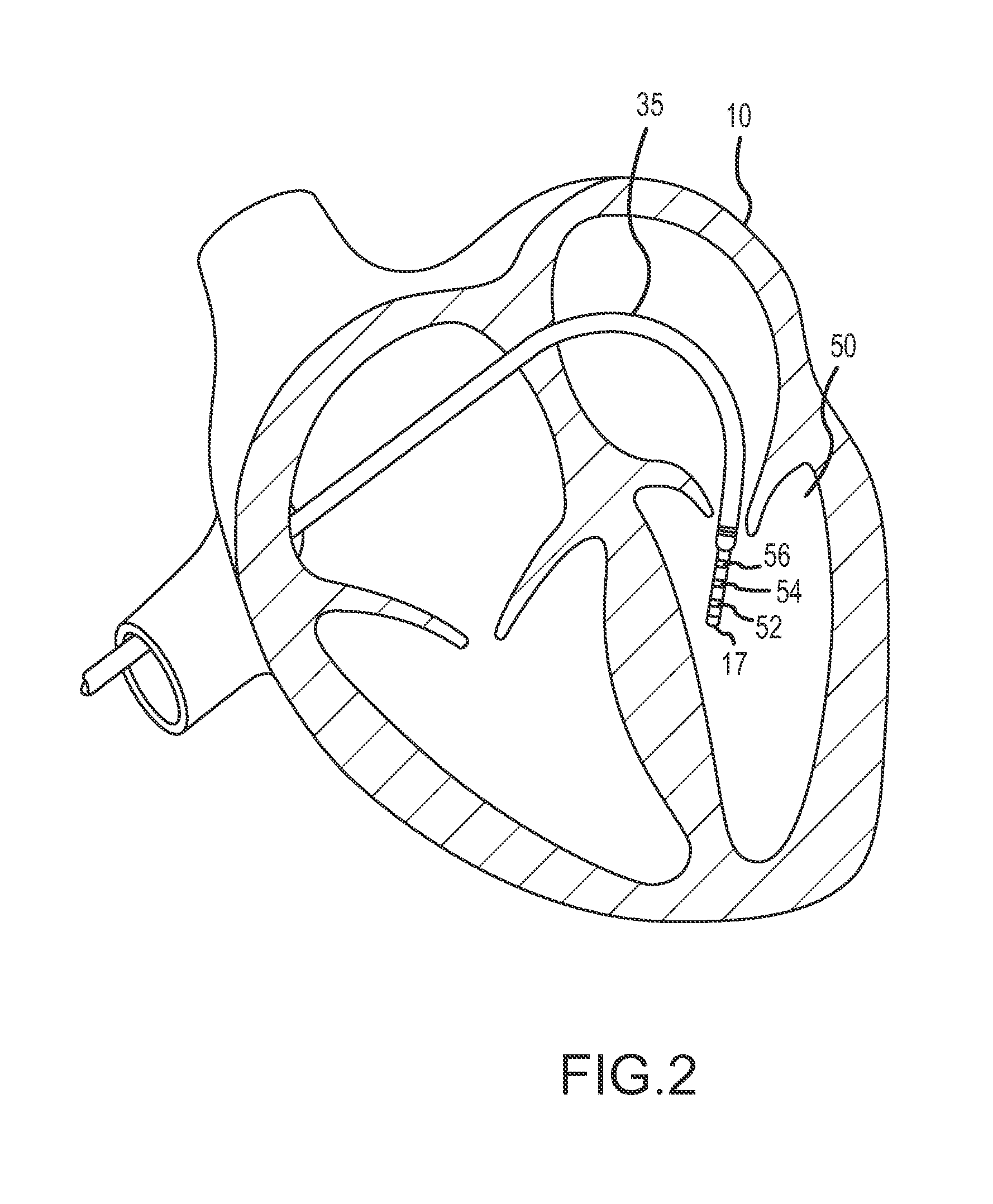 Systems and Methods for Generating, Storing, and Displaying Anatomical Maps