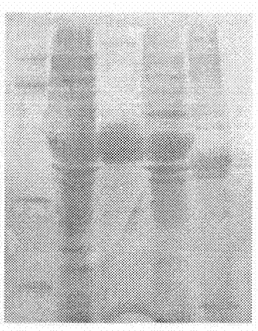 Medicament carrier for targeted medicament delivery on diseases related to macrophage and preparation method thereof