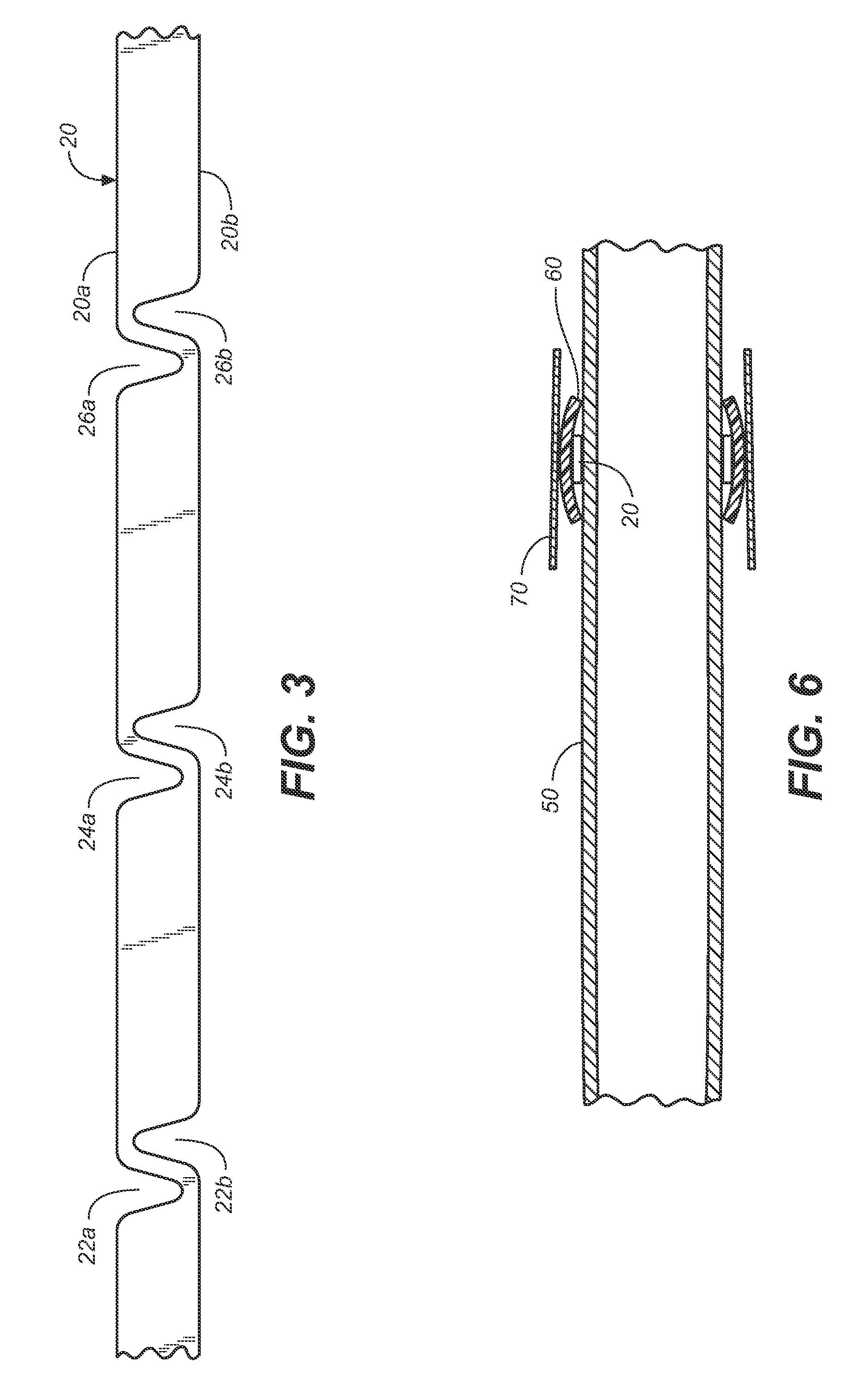 Vascular fluoroscopic marker