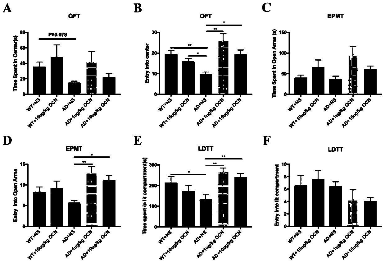 Application of osteocalcin to preparation of medicines for Alzheimer's disease