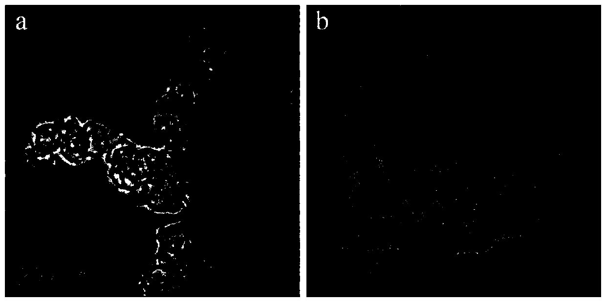 Method for detecting brain natriuretic peptide through composite probe fluorescence "turning on-turning off-turning on" strategy on basis of cobalt nanomaterial/nucleic acid aptamer