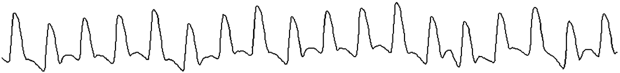 A multi-point pulse wave detection method and device