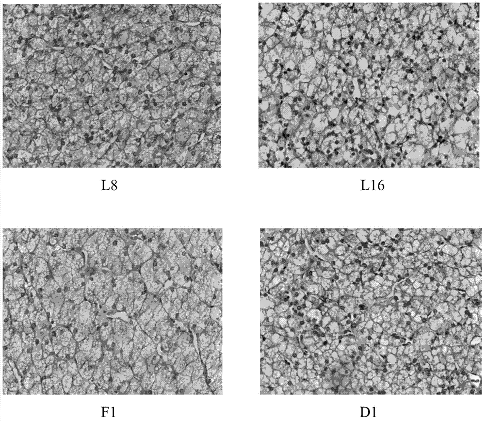 Traditional Chinese medicine composition for controlling sturgeon fatty liver as well as preparation method and application of traditional Chinese medicine composition