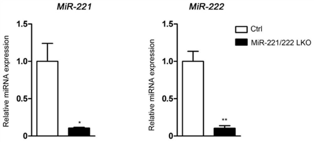 mir-221/222 and its inhibitors are used to prepare drugs for regulating hepatic fat deposition, liver fibrosis and hepatocellular carcinoma