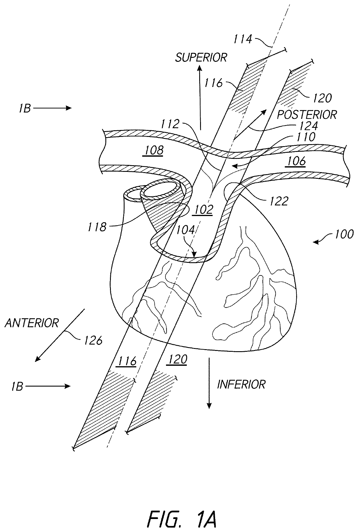 Systems and methods of facilitating therapeutic neuromodulation