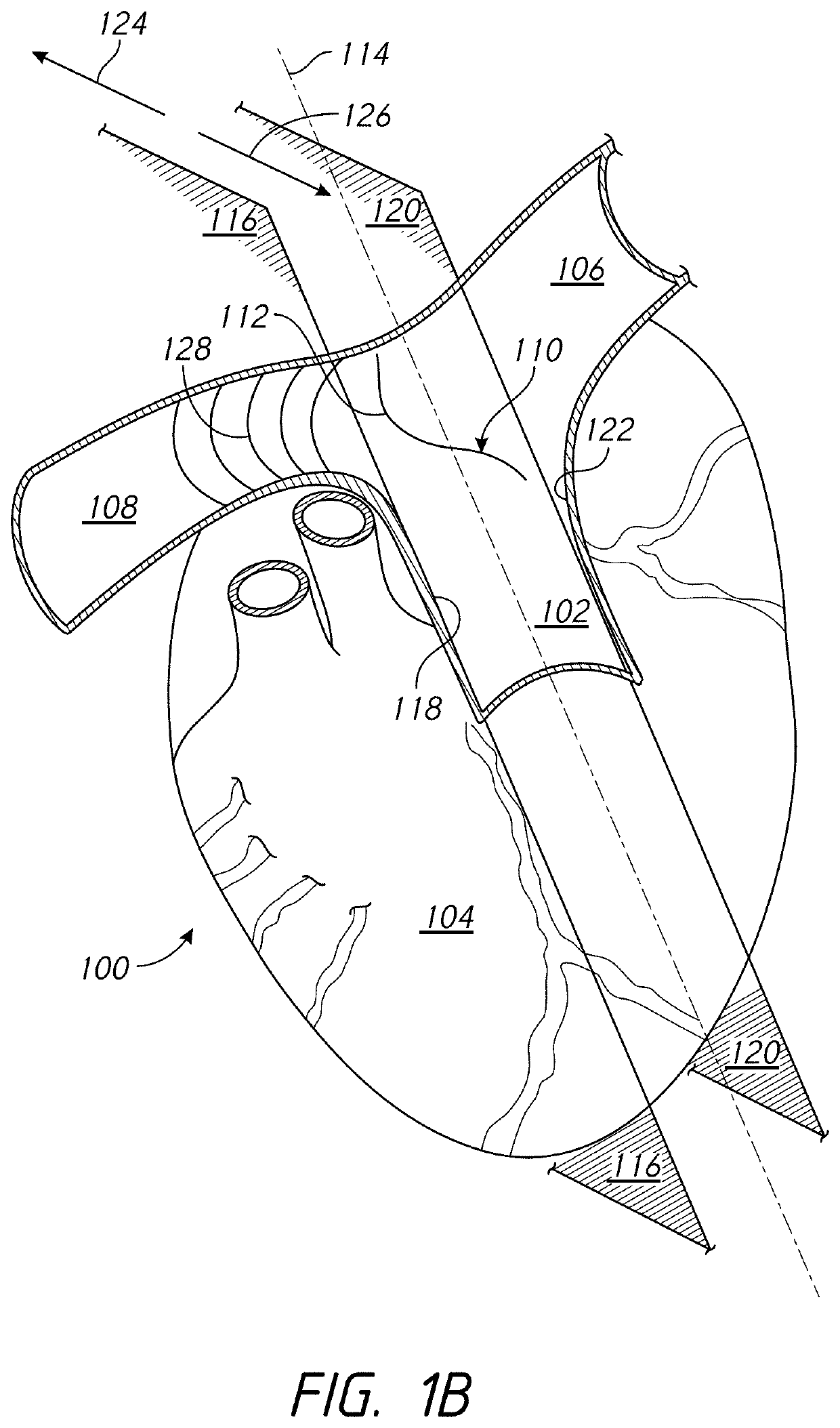 Systems and methods of facilitating therapeutic neuromodulation