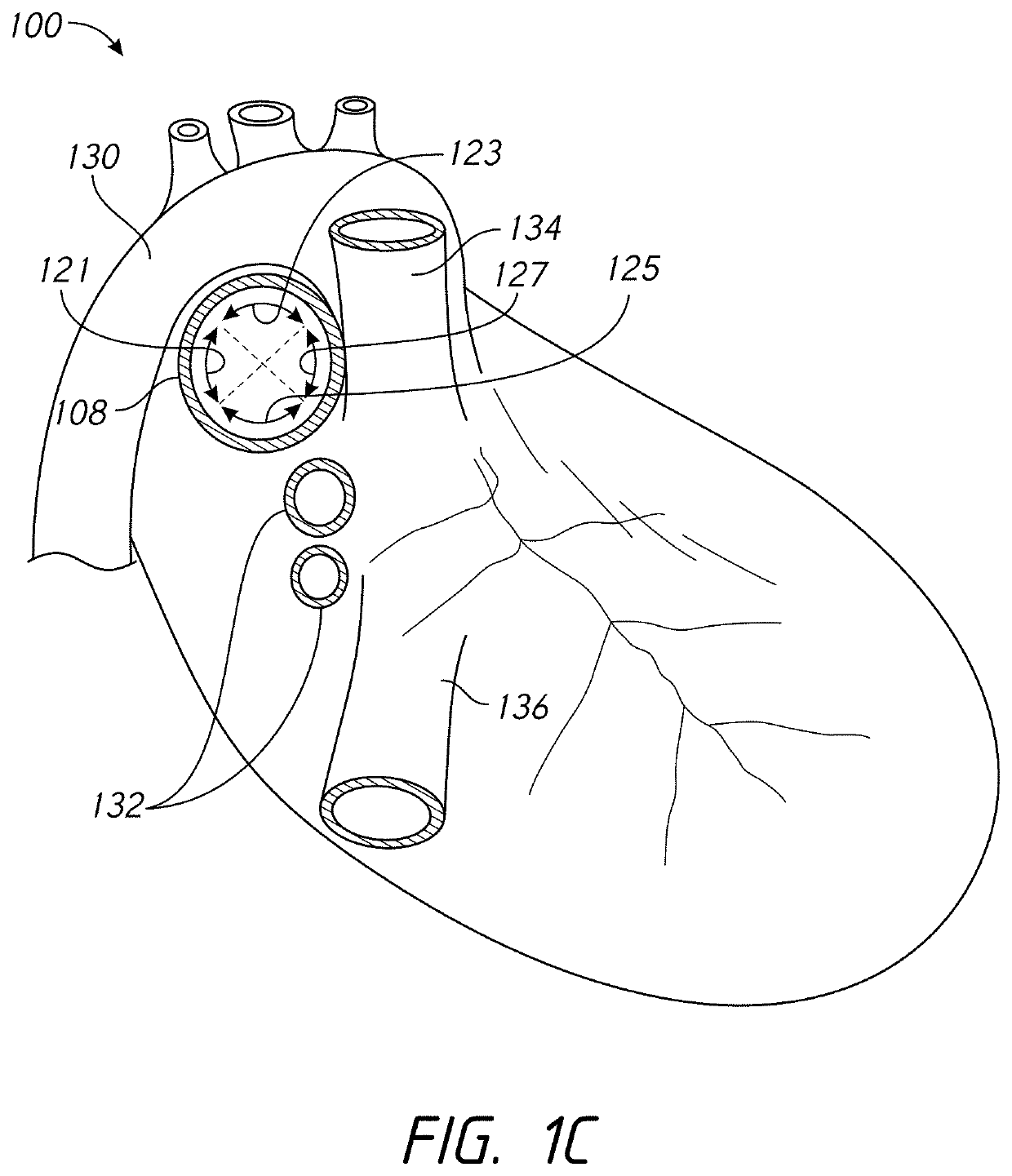 Systems and methods of facilitating therapeutic neuromodulation