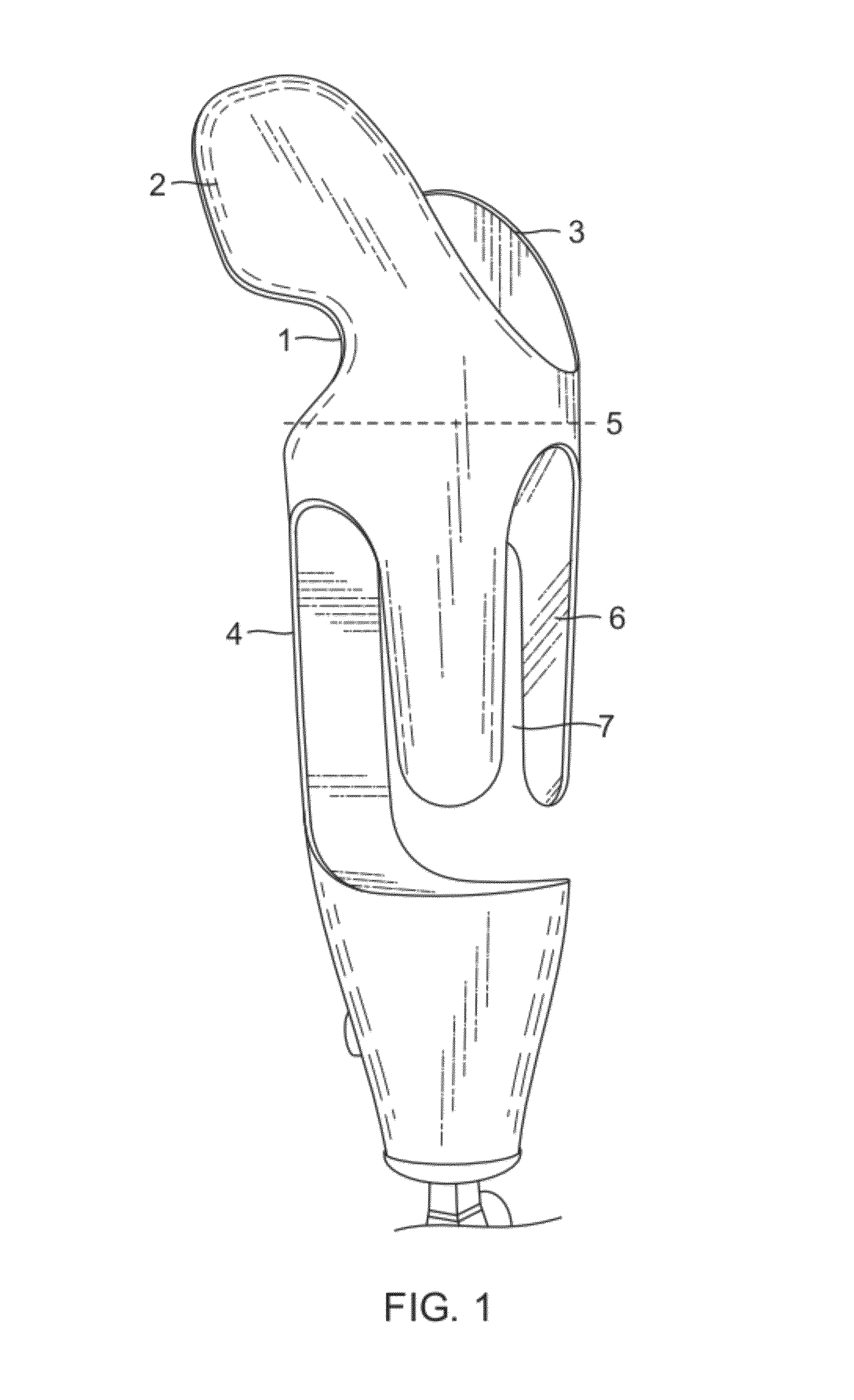 Method for use of a compression stabilized prosthetic socket interface