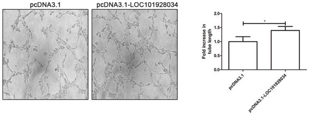 A drug for treating acute myocardial infarction