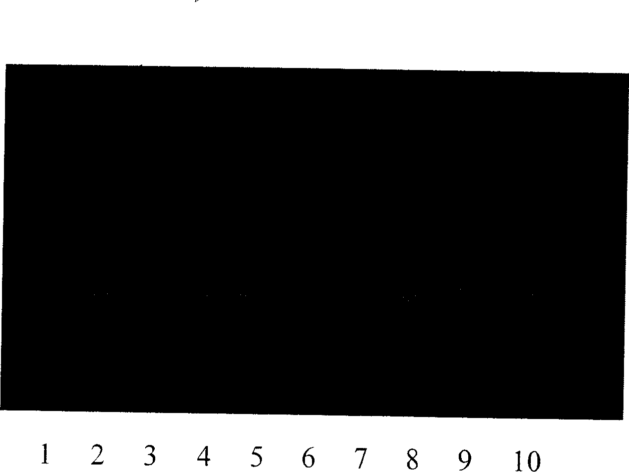 Idiosyncratic primer of repetitive sequence in gamma chromosome of oxen, and PRC method for identifying sex in early embryos of oxen