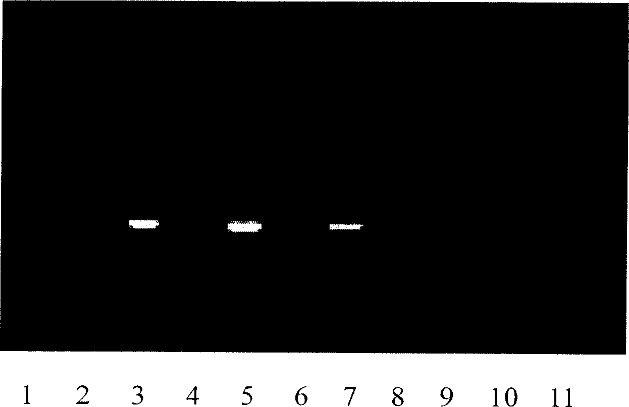 Idiosyncratic primer of repetitive sequence in gamma chromosome of oxen, and PRC method for identifying sex in early embryos of oxen