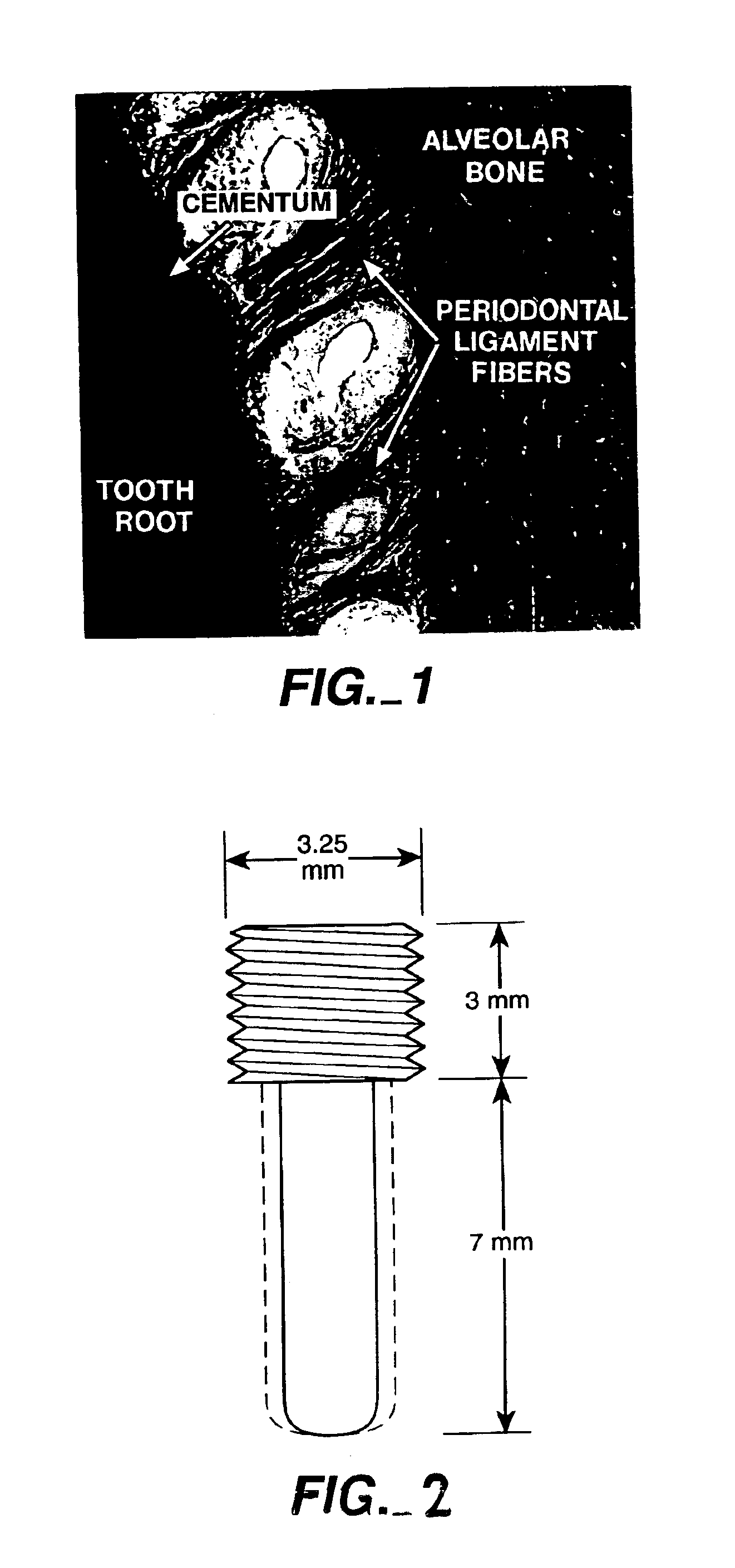 Combined use of cementum attachment protein and cyclosporin a for improved attachment of dental and orthopedic implants