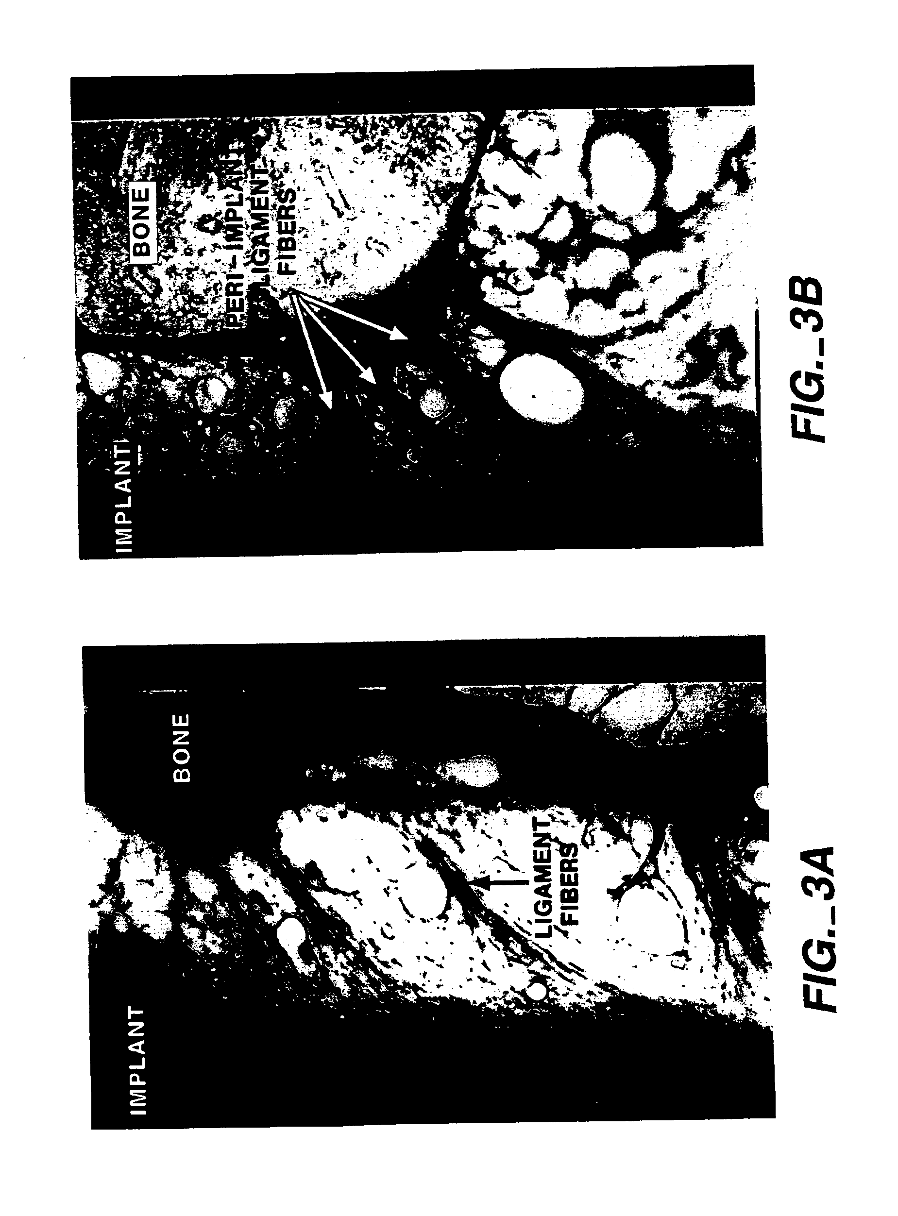 Combined use of cementum attachment protein and cyclosporin a for improved attachment of dental and orthopedic implants