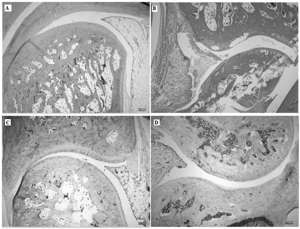 Application of matrine in preparation of anti-rheumatoid arthritis drugs