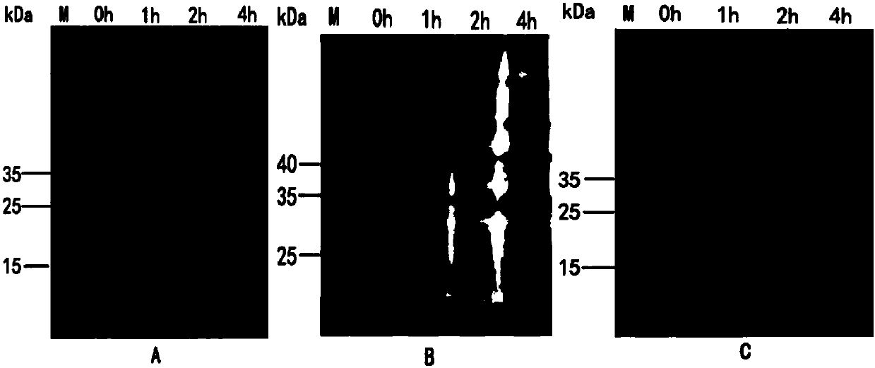 Schistosoma japonicum recombinant antigen rSjMRP1 and application thereof