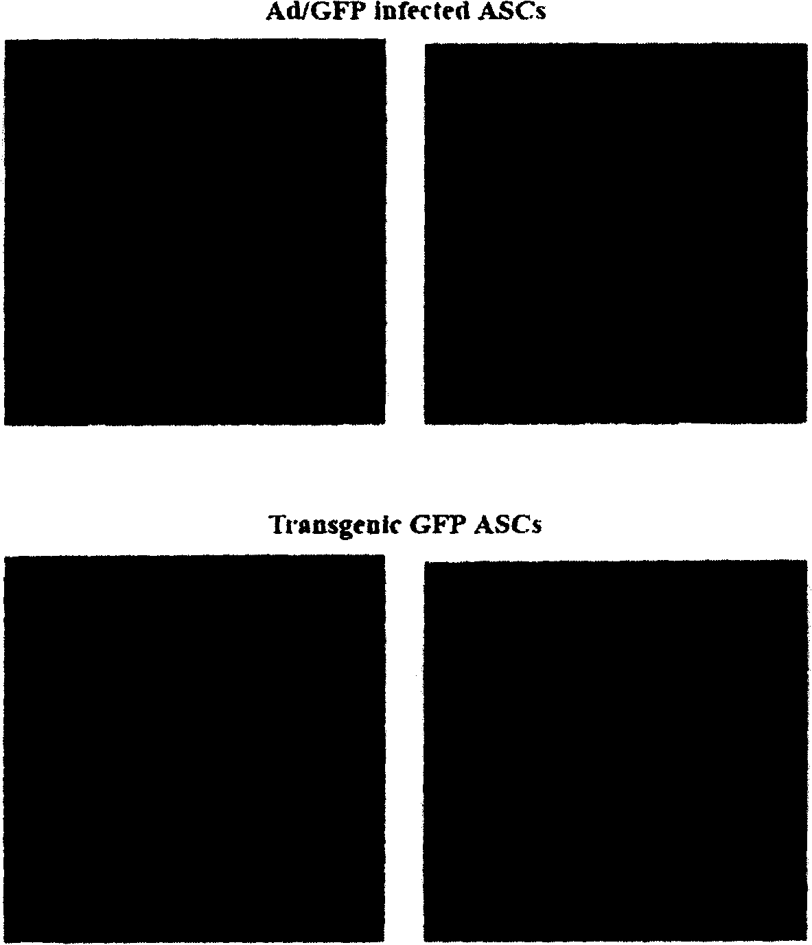 Method for adipose-derived adult stem cell labeling by using exogenous green fluorescent protein (GFP)