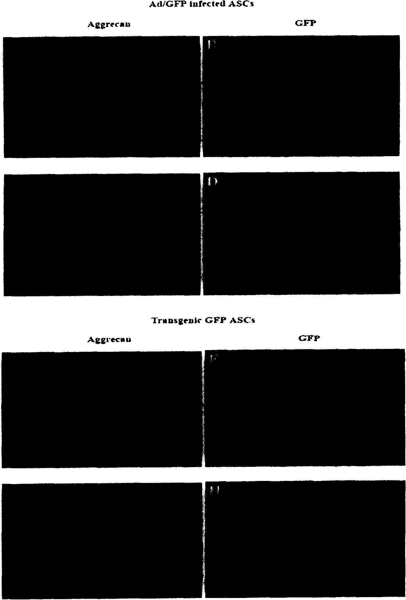 Method for adipose-derived adult stem cell labeling by using exogenous green fluorescent protein (GFP)