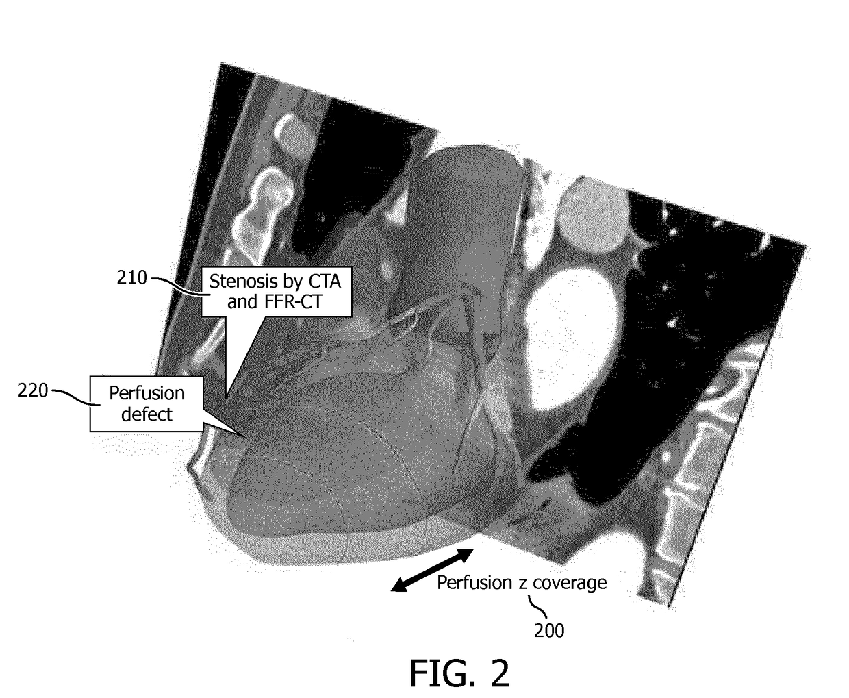 Ct perfusion protocol targeting