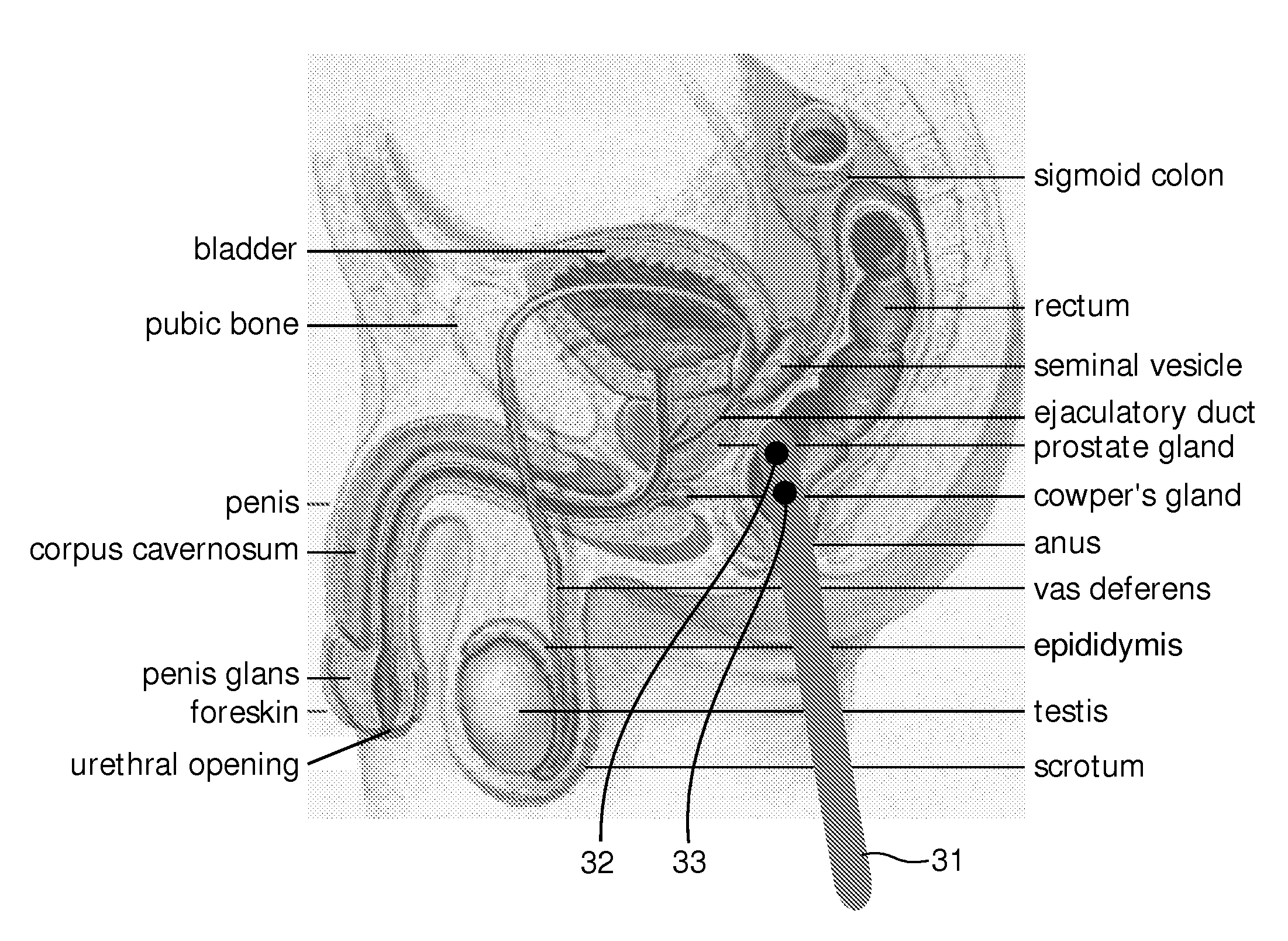System, device, method, computer-readable medium, and use for in vivo imaging of tissue in an anatomical structure