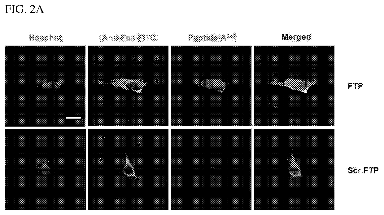 Composition for treating apoplexy through nasal administration