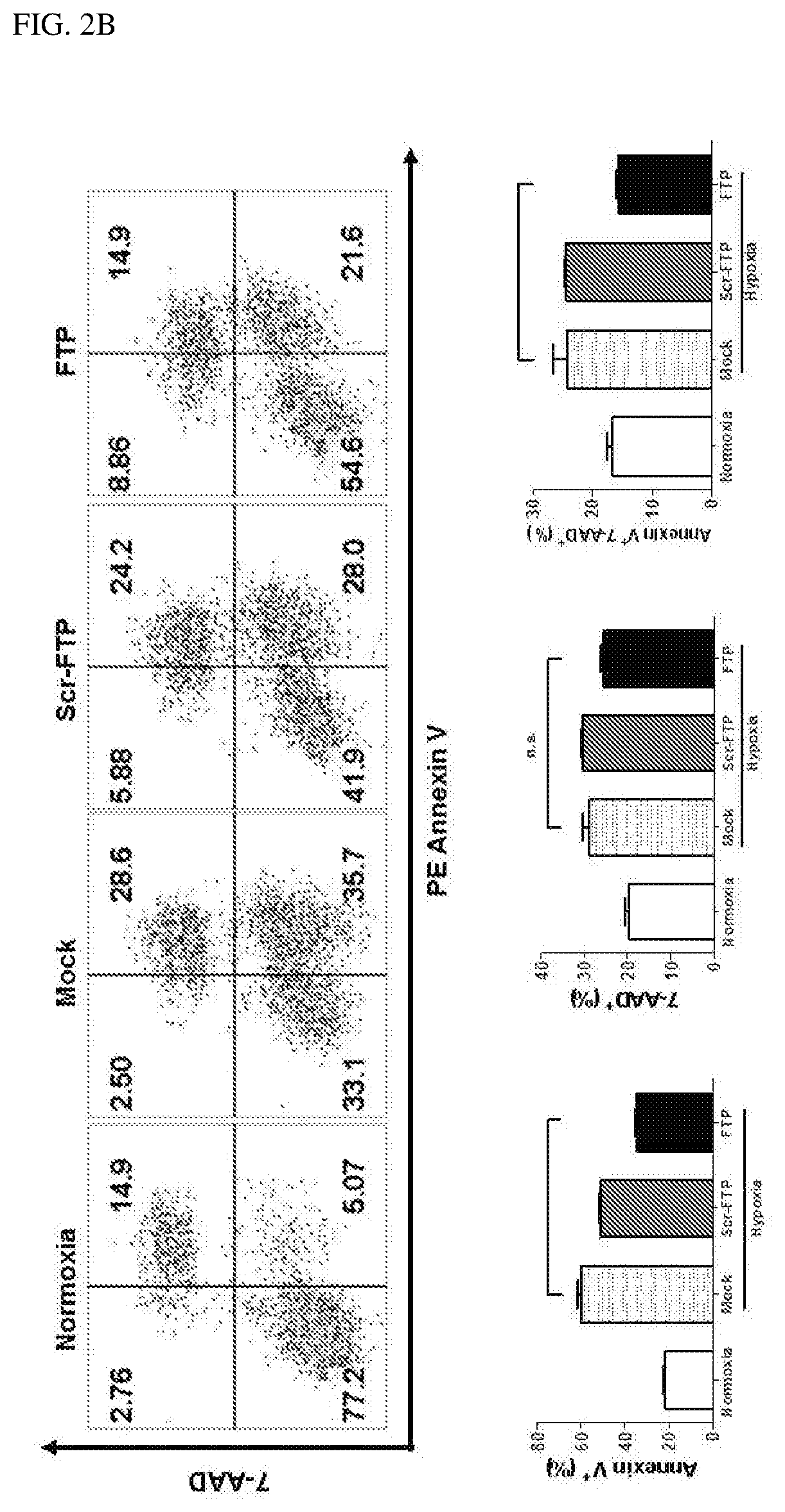 Composition for treating apoplexy through nasal administration