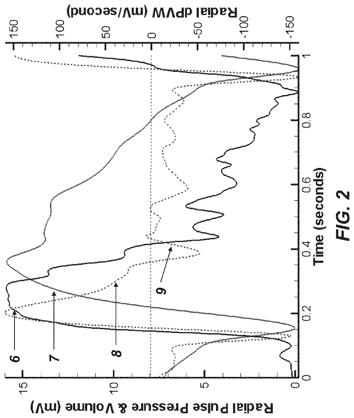 Method to Quantify the Hemodynamic and Vascular Properties in Vivo from Arterial Waveform Measurements