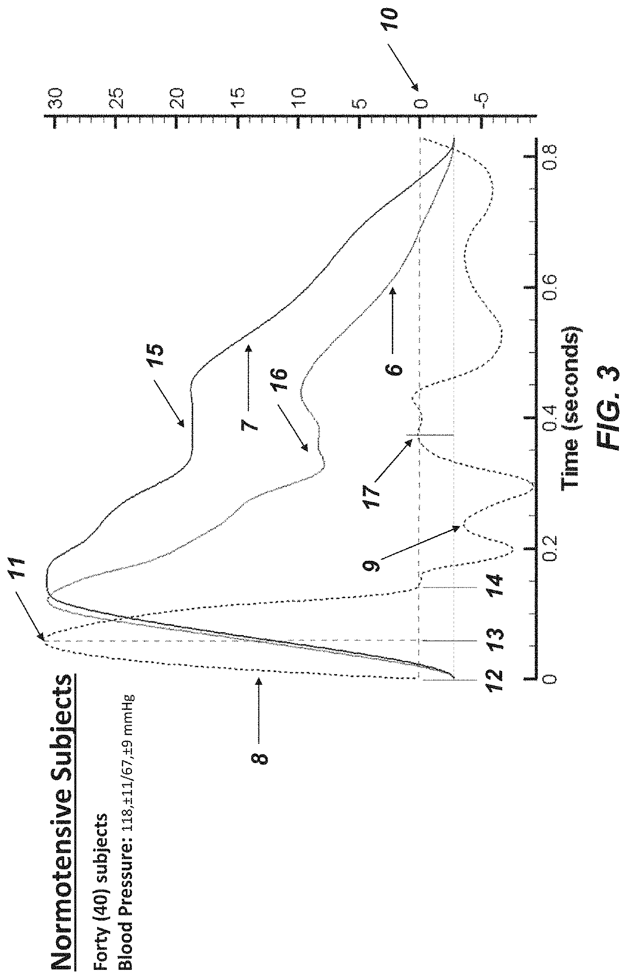 Method to Quantify the Hemodynamic and Vascular Properties in Vivo from Arterial Waveform Measurements