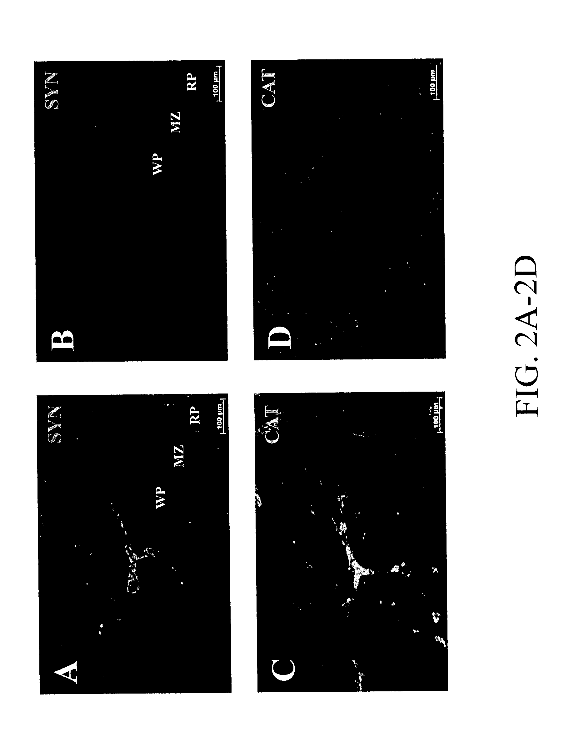 Methods and systems for reducing inflammation by neuromodulation and administration of an Anti-inflammatory drug