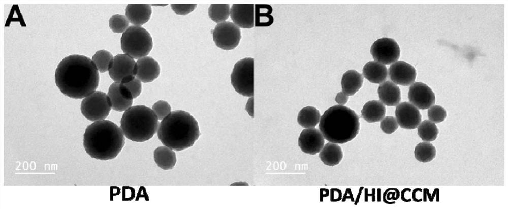Nano photothermal therapy drug and preparation method thereof