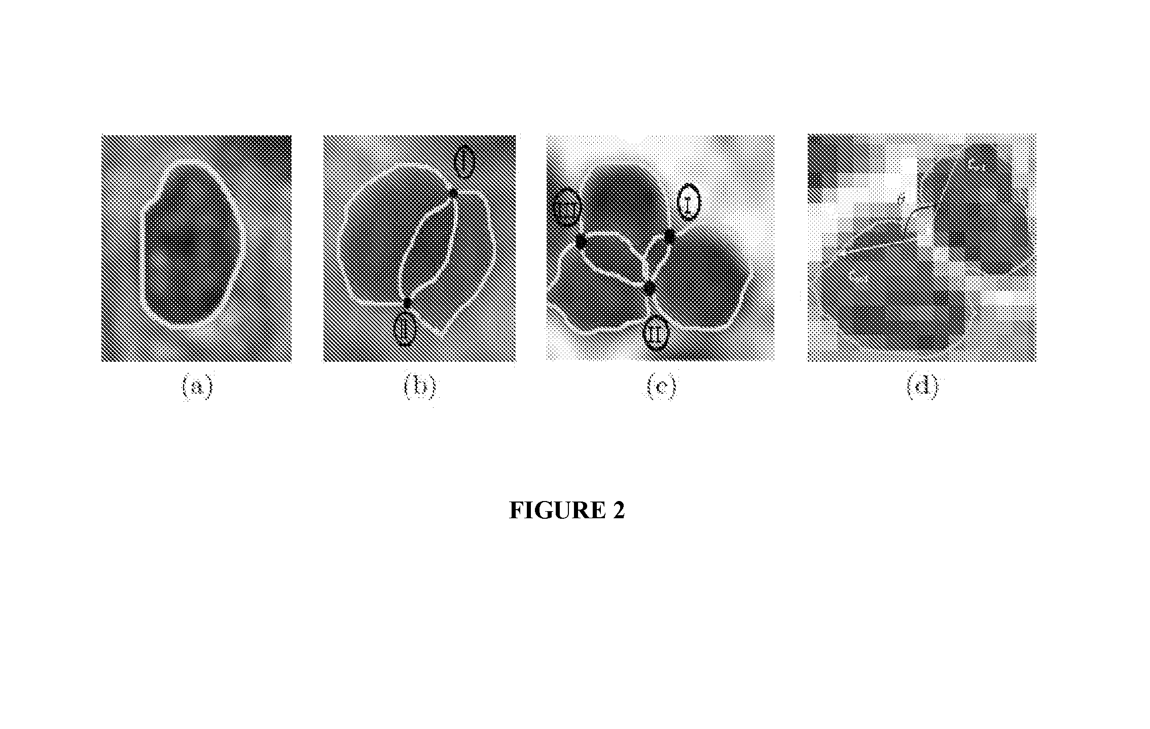 Method and apparatus for shape based deformable segmentation of multiple overlapping objects