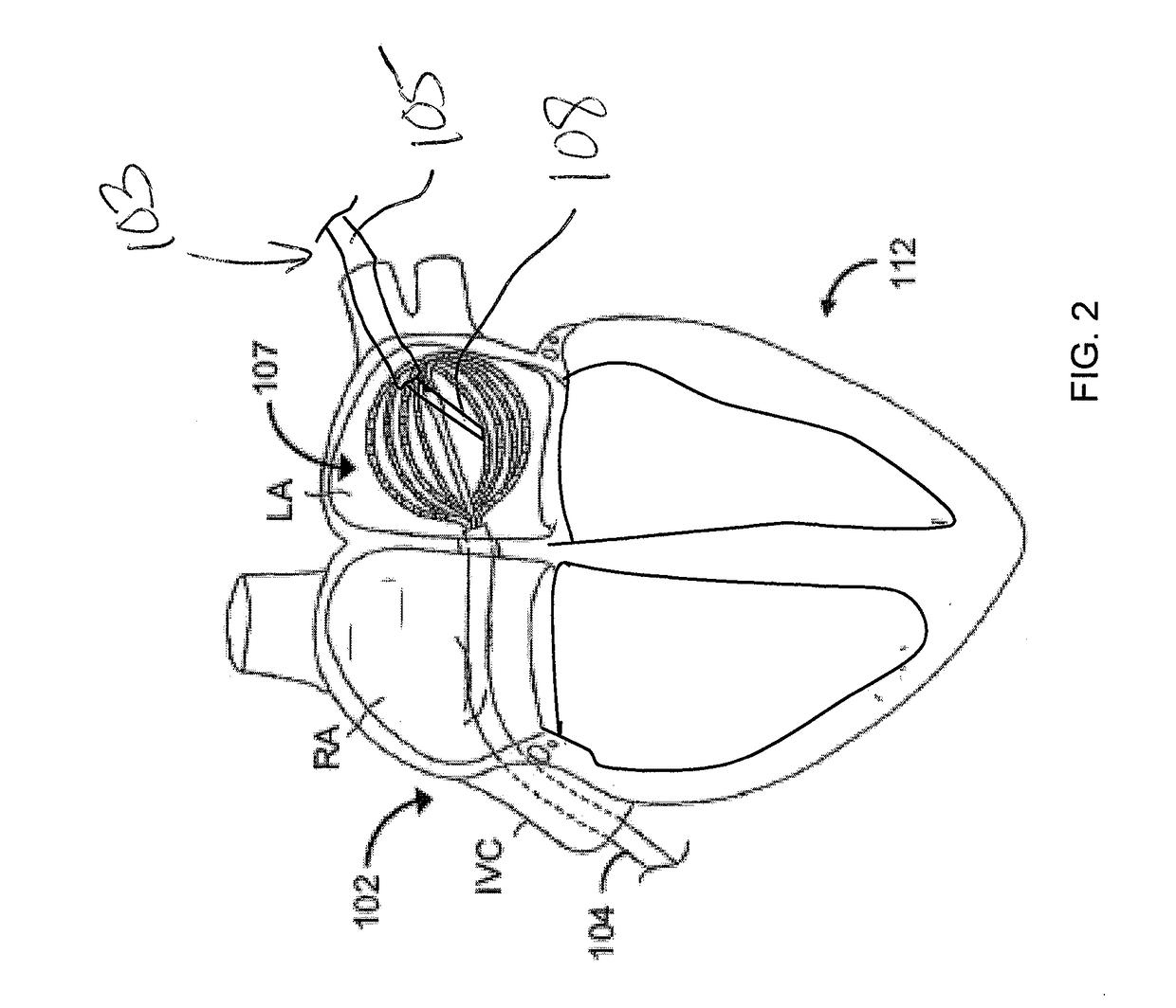 Coordination/control of multiple medical devices at a site