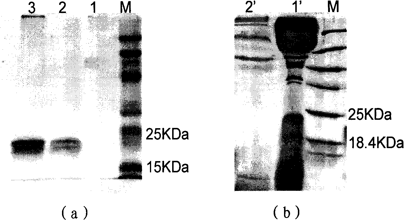 Fusion protein for resisting formation of thrombus targetedly and preparation method and application thereof