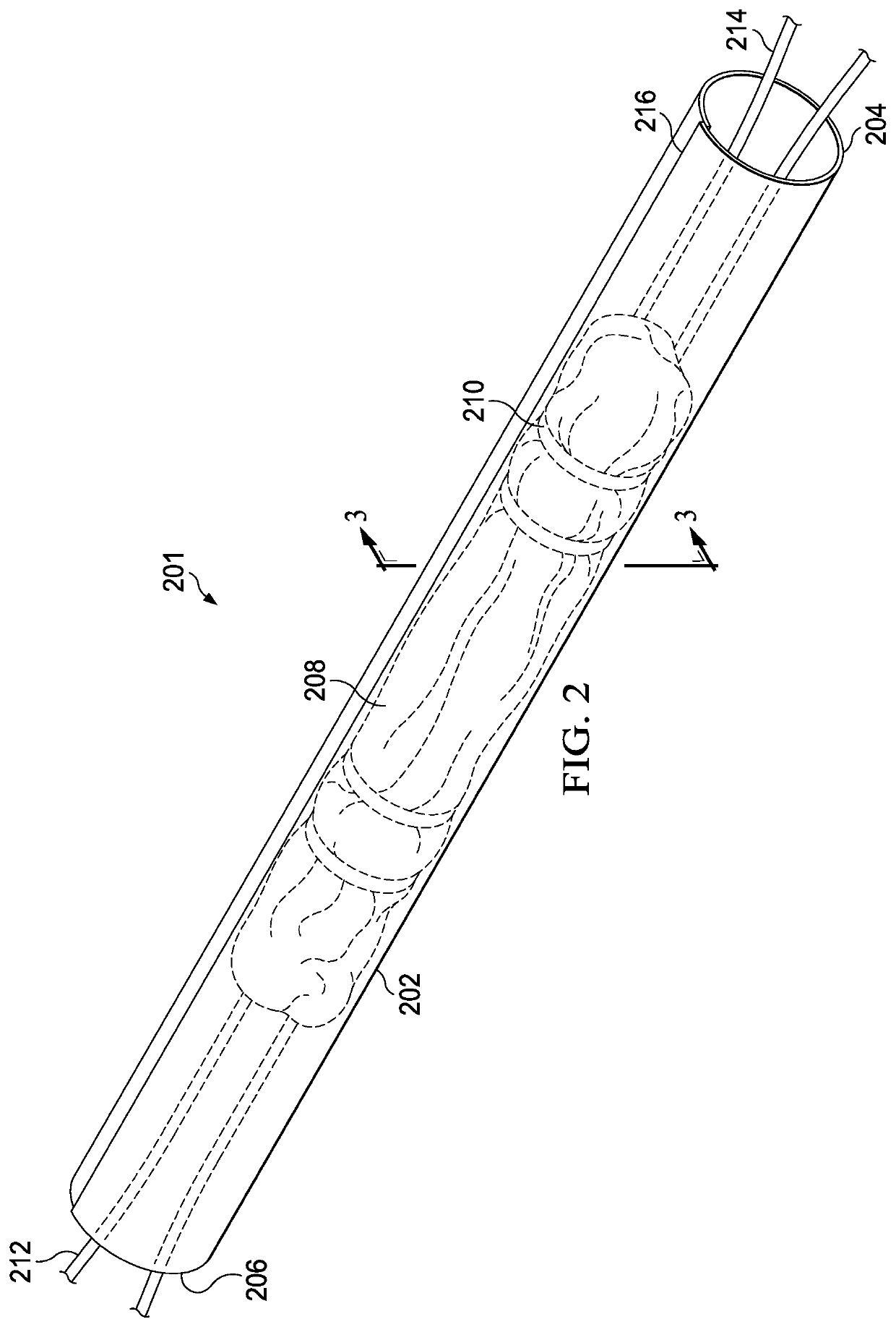 Graft Compression System