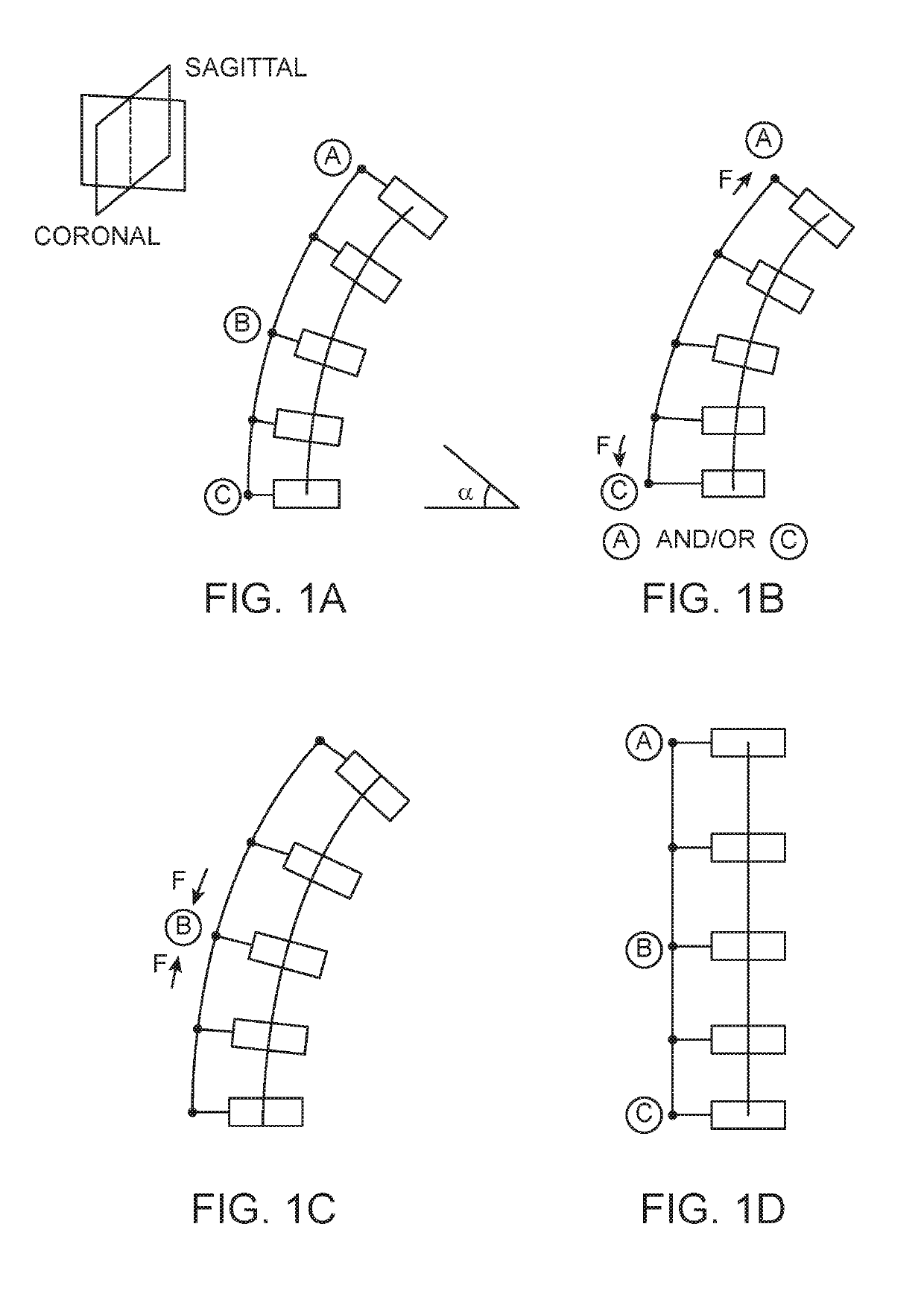 Spinal Curvature Modulation Systems and Methods